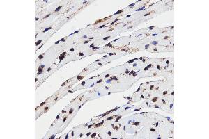 Immunohistochemistry of paraffin-embedded mouse heart using HMGB1 antibody (ABIN3059694) at dilution of 1/100 (40x lens).