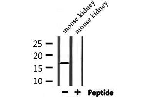 Western Blotting (WB) image for anti-NADH Dehydrogenase (Ubiquinone) 1 alpha Subcomplex, 13 (NDUFA13) (N-Term) antibody (ABIN6263558)