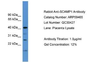 WB Suggested Anti-SCAMP1  Antibody Titration: 0.