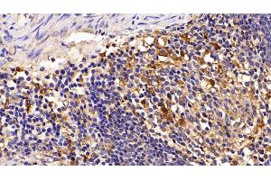 Detection of CTSS in Porcine Spleen Tissue using Polyclonal Antibody to Cathepsin S (CTSS) (Cathepsin S Antikörper  (AA 115-331))