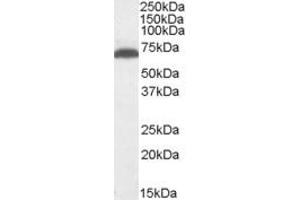 ABIN334405 (1µg/ml) staining of Mouse Brain lysate (35µg protein in RIPA buffer). (GAD Antikörper  (Internal Region))