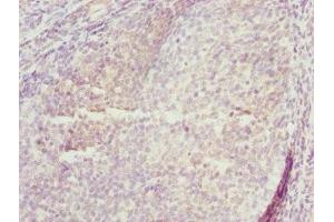 Immunohistochemistry of paraffin-embedded human tonsil tissue using ABIN7173433 at dilution of 1:100 (TRIM29 Antikörper  (AA 309-588))