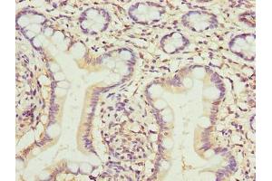 Immunohistochemistry of paraffin-embedded human small intestine tissue using ABIN7173079 at dilution of 1:100 (TMEM154 Antikörper  (AA 97-183))