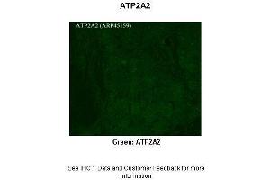 Sample Type :  Rhesus macaque spinal cord  Primary Antibody Dilution :  1:300  Secondary Antibody :  Donkey anti Rabbit 488  Secondary Antibody Dilution :  1:500  Color/Signal Descriptions :  Green: ATP2A2  Gene Name :  APLP2  Submitted by :  Timur Mavlyutov, Ph. (ATP2A2 Antikörper  (C-Term))