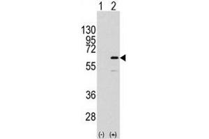 Western blot analysis of ELK1 (arrow) using rabbit polyclonal ELK1 Antibody  (R). (ELK1 Antikörper  (AA 361-390))