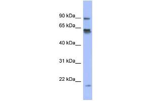 WB Suggested Anti-LRRFIP1 Antibody Titration:  0.