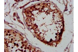 IHC image of ABIN7155501 diluted at 1:400 and staining in paraffin-embedded human testis tissue performed on a Leica BondTM system. (WHSC1 Antikörper  (AA 1-44))