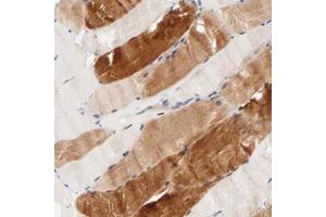 Immunohistochemical staining of human skeletal muscle with AFF2 polyclonal antibody  shows strong cytoplasmic positivity in myocytes.