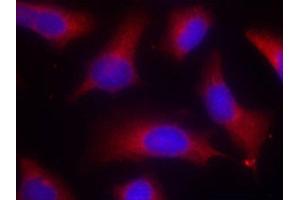 Immunofluorescence staining of methanol-fixed Hela cells using Phospho-MAPT-S262 antibody. (MAPT Antikörper  (pSer262))