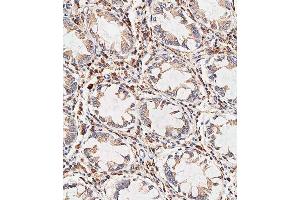 Immunohistochemical analysis of paraffin-embedded human colon tissue using C performed on the Leica® BOND RXm. (NOX1 Antikörper  (AA 243-271))