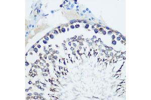 Immunohistochemistry of paraffin-embedded rat testis using CCR7 Rabbit mAb (ABIN7266309) at dilution of 1:100 (40x lens). (CCR7 Antikörper)