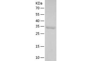 Western Blotting (WB) image for Tryptophan Hydroxylase 1 (TPH1) (AA 105-420) protein (His tag) (ABIN7125511)