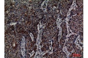 Immunohistochemistry (IHC) image for anti-Minichromosome Maintenance Complex Component 3 (MCM3) (Internal Region) antibody (ABIN6287318)