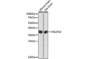 Western blot analysis of extracts of various cell lines using TAS2R10 Polyclonal Antibody at dilution of 1:1000. (TAS2R10 Antikörper)