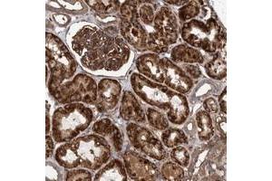 Immunohistochemical staining of human kidney with MRPL12 polyclonal antibody  shows strong cytopmasmic positivity with granular pattern in cells in tubules and cells in glomeruli. (SLC25A10 Antikörper)