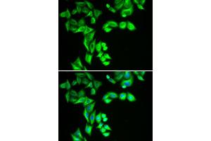 Immunofluorescence analysis of HeLa cell using STRN3 antibody. (STRN3 Antikörper)