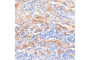 Immunohistochemistry of paraffin-embedded rat spleen using APCS antibody (ABIN3022713, ABIN3022714, ABIN3022715, ABIN1512583 and ABIN6219158) at dilution of 1:100 (40x lens). (APCS Antikörper  (AA 1-223))
