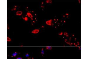 Immunofluorescence analysis of HeLa cells using CCT8 Polyclonal Antibody at dilution of 1:100 (40x lens). (CCT8 Antikörper)