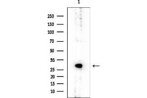 Western blot analysis of lysates from COLO205 cells, using RPS4Y1 Mouse Monoclonal Antibody at 1/1000 dilution.