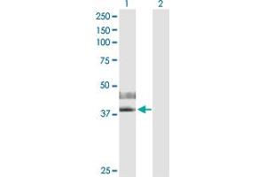 Western Blot analysis of IL2RG expression in transfected 293T cell line by IL2RG MaxPab polyclonal antibody.