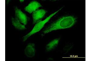 Immunofluorescence of monoclonal antibody to TBC1D8 on HeLa cell.