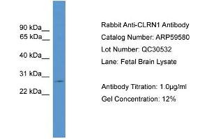 WB Suggested Anti-CLRN1  Antibody Titration: 0.