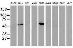 Image no. 7 for anti-Tumor Protein P53 (TP53) antibody (ABIN1499972) (p53 Antikörper)