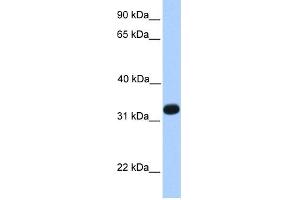 WB Suggested Anti-ACRV1 Antibody Titration: 0. (ACRV1 Antikörper  (N-Term))