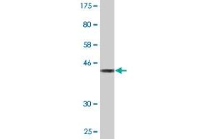 Western Blot detection against Immunogen (43. (GPSM3 Antikörper  (AA 1-160))