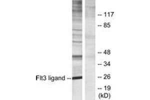 Western blot analysis of extracts from Jurkat cells, using Flt3 ligand Antibody. (FLT3LG Antikörper  (AA 171-220))