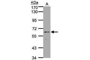 Western Blotting (WB) image for anti-Purinergic Receptor P2X, Ligand-Gated Ion Channel, 7 (P2RX7) (Center) antibody (ABIN2855803)