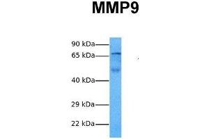 Host:  Rabbit  Target Name:  MMP9  Sample Tissue:  Human Fetal Lung  Antibody Dilution:  1.