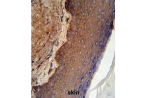 Immunohistochemistry (IHC) image for anti-Keratin 9 (KRT9) antibody (ABIN3003130) (KRT9 Antikörper)