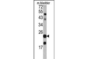 Western blot analysis of TAGLN antibody (C-term) (ABIN390627 and ABIN2840932) in mouse bladder tissue lysates (35 μg/lane).