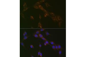 Immunofluorescence analysis of NIH-3T3 cells using RA Rabbit mAb (ABIN7269817) at dilution of 1:100 (40x lens). (RAB9A Antikörper)