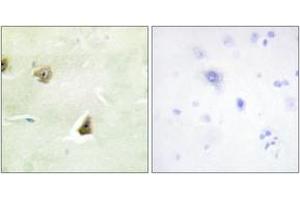 Immunohistochemistry analysis of paraffin-embedded human brain tissue, using DUSP6 Antibody. (DUSP6 Antikörper  (AA 61-110))