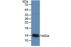 Western blot analysis of recombinant Human bTG. (beta-Thromboglobulin Antikörper  (AA 59-128))