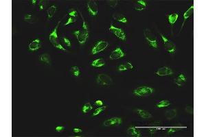 Immunofluorescence of purified MaxPab antibody to MTDH on HeLa cell. (MTDH Antikörper  (AA 1-582))