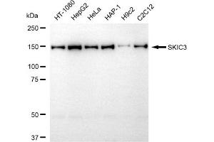 Western blotting analysis using SKIC3 antibody (ABIN7800360). (SKIC3 Antikörper)
