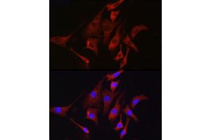 Immunofluorescence analysis of NIH/3T3 cells using TMPRSS2 Rabbit pAb (ABIN6132728, ABIN6149286, ABIN6149287 and ABIN6219138) at dilution of 1:50 (40x lens).
