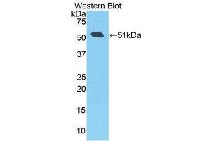 Western Blotting (WB) image for anti-Amyloid beta (A4) Precursor Protein (APP) (AA 672-711) antibody (ABIN3207377)