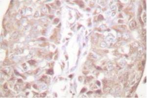 Image no. 2 for anti-SUMO1/sentrin Specific Peptidase 1 (SENP1) antibody (ABIN271955) (SENP1 Antikörper)