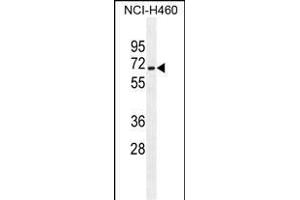 ZSCAN5B Antibody (C-term) (ABIN655366 and ABIN2844923) western blot analysis in NCI- cell line lysates (35 μg/lane). (ZSCAN5B Antikörper  (C-Term))