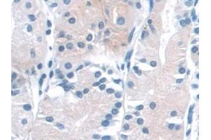 Detection of NADK in Human Stomach Tissue using Polyclonal Antibody to NAD Kinase (NADK) (NADK Antikörper  (AA 187-426))