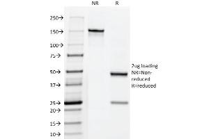 SDS-PAGE (SDS) image for anti-Fascin (FSCN1) antibody (ABIN6940609)
