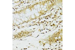 Immunohistochemistry (Paraffin-embedded Sections) (IHC (p)) image for anti-Adenosine Deaminase, RNA-Specific (ADAR) (AA 150-250) antibody (ABIN6136553)