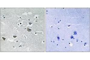 Immunohistochemistry analysis of paraffin-embedded human brain tissue, using SREBP-1 (Ab-439) Antibody. (SREBF1 Antikörper  (AA 405-454))