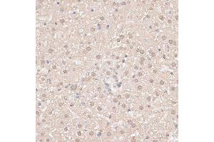 Immunohistochemistry (Paraffin-embedded Sections) (IHC (p)) image for anti-G Patch Domain and KOW Motifs (GPKOW) (AA 127-476) antibody (ABIN6141332)