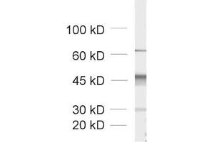 dilution: 1 : 1000, sample: crude synaptic vesicle fraction of rat brain (LP2) (Doc 2a/b Antikörper)