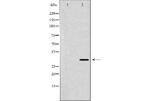 Western blot analysis of extracts of HepG2 cells, using HLA-DRB3 antibody. (HLA-DRB3 Antikörper)